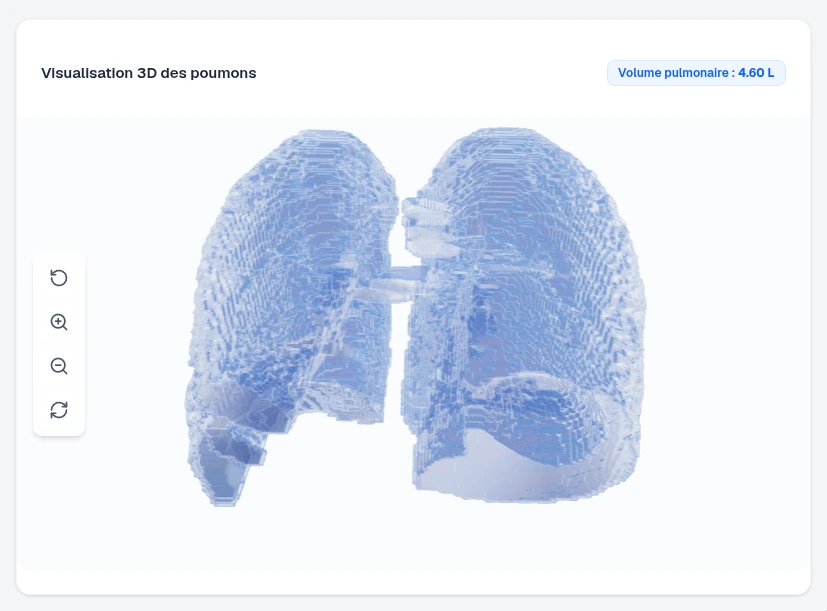 Reconstruction 3D du parenchyme pulmonaire à partir des coupes segmentées