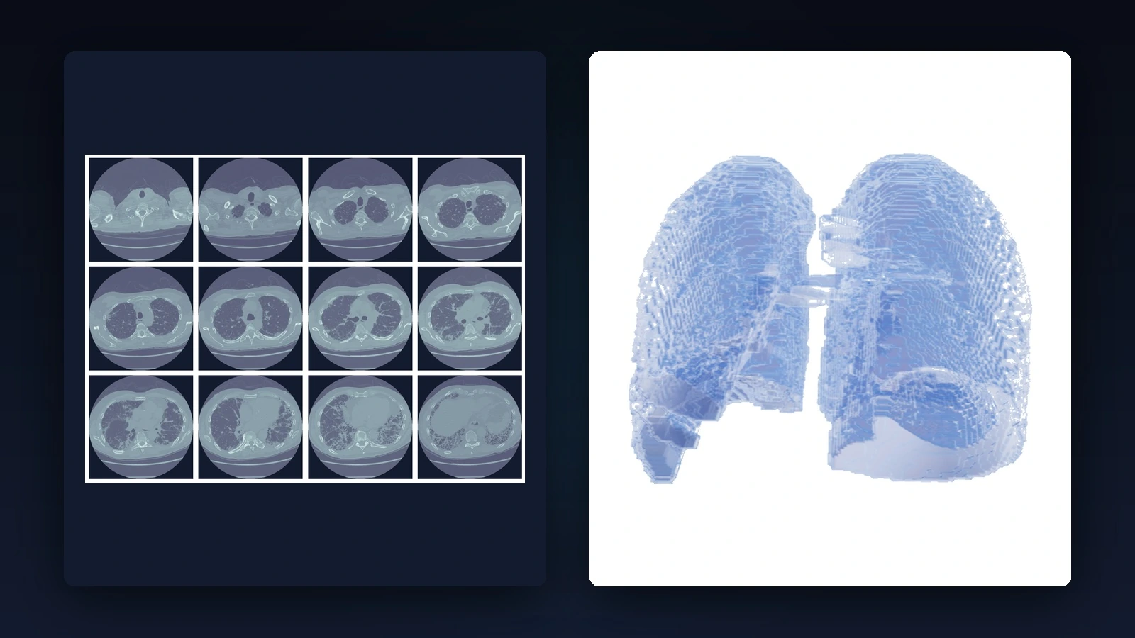 Aperçu du projet MedViz