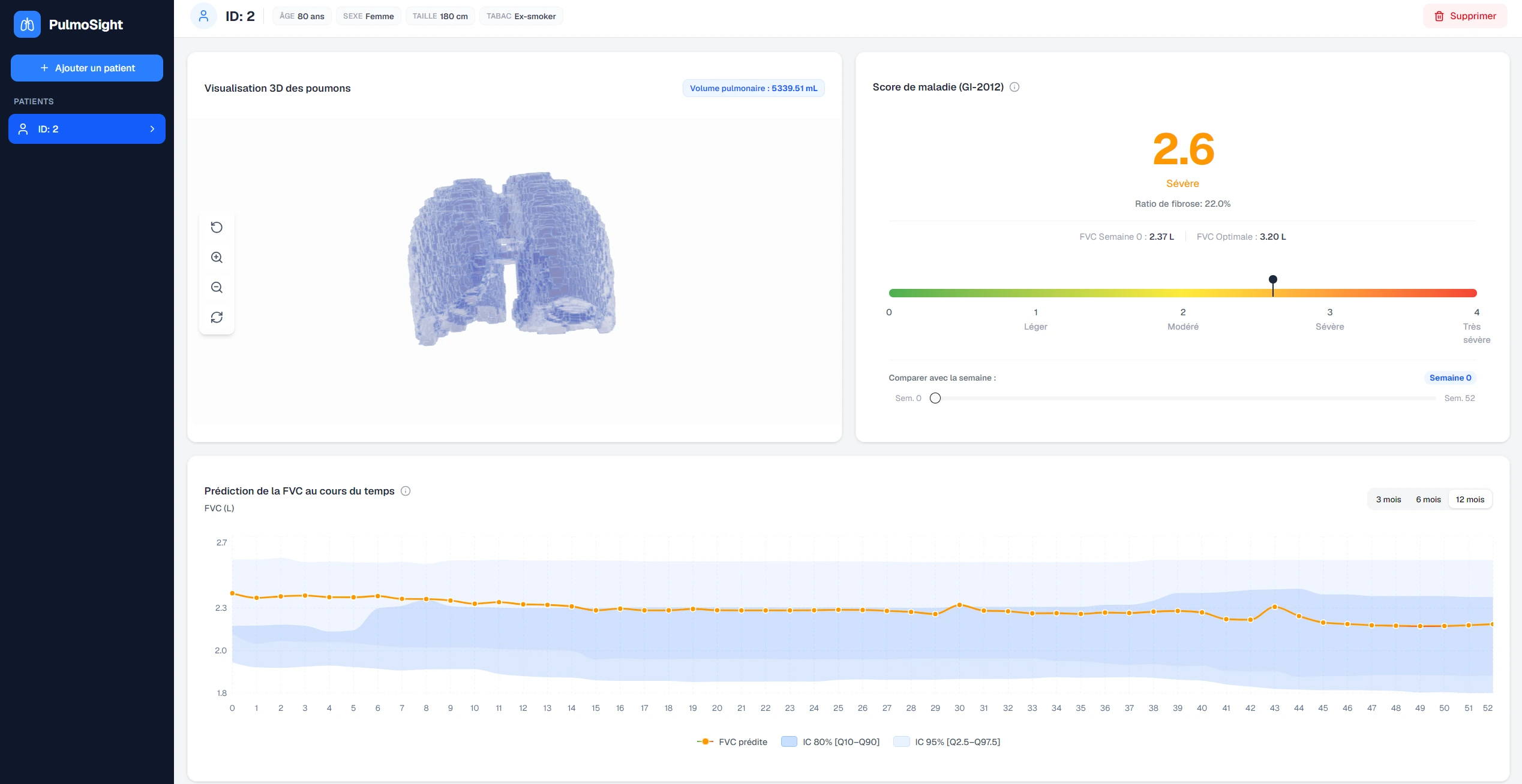 Vue d’ensemble de l’interface utilisateur de MedViz