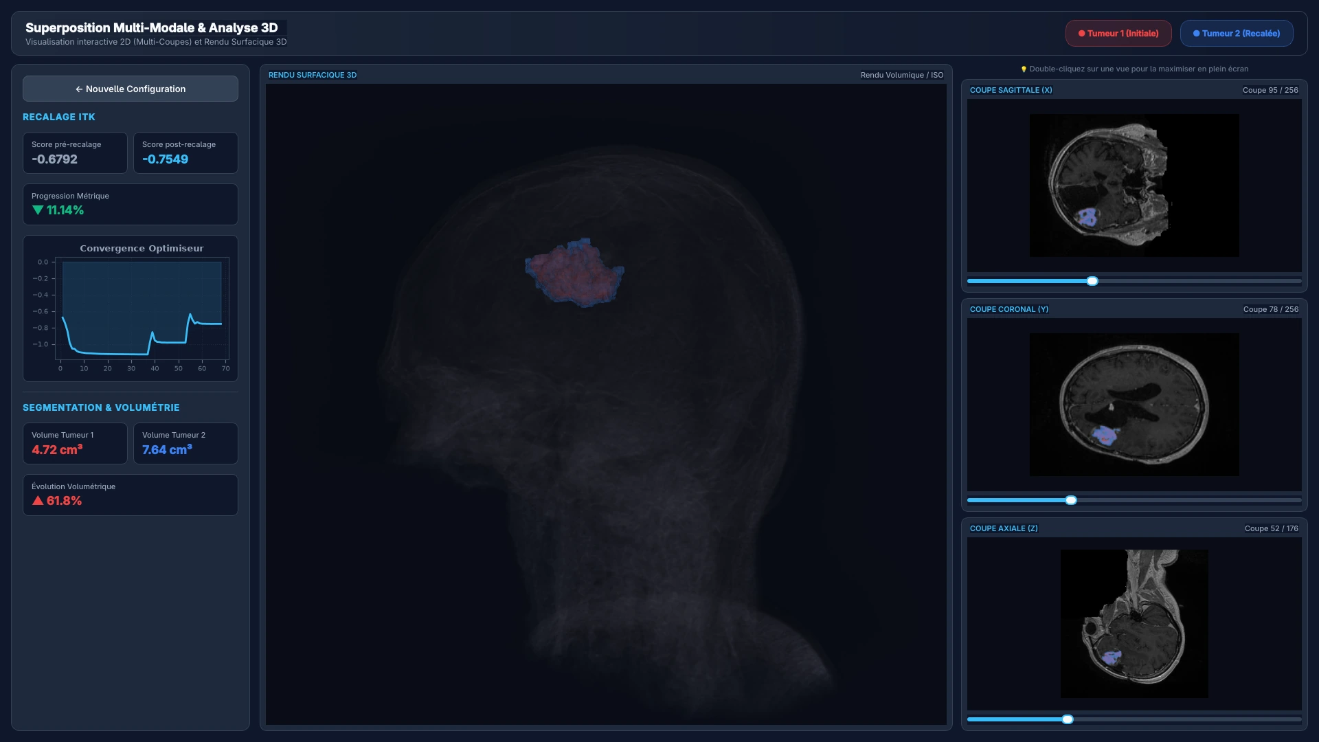 Dashboard — Synchronized 3D visualization and 2D slices